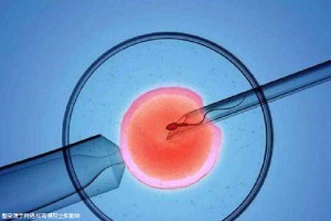 人工孕妈代怀助孕咨询怎么选
